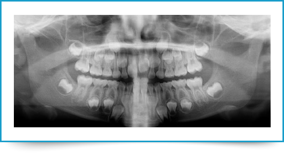Ortodonzia pediatrica